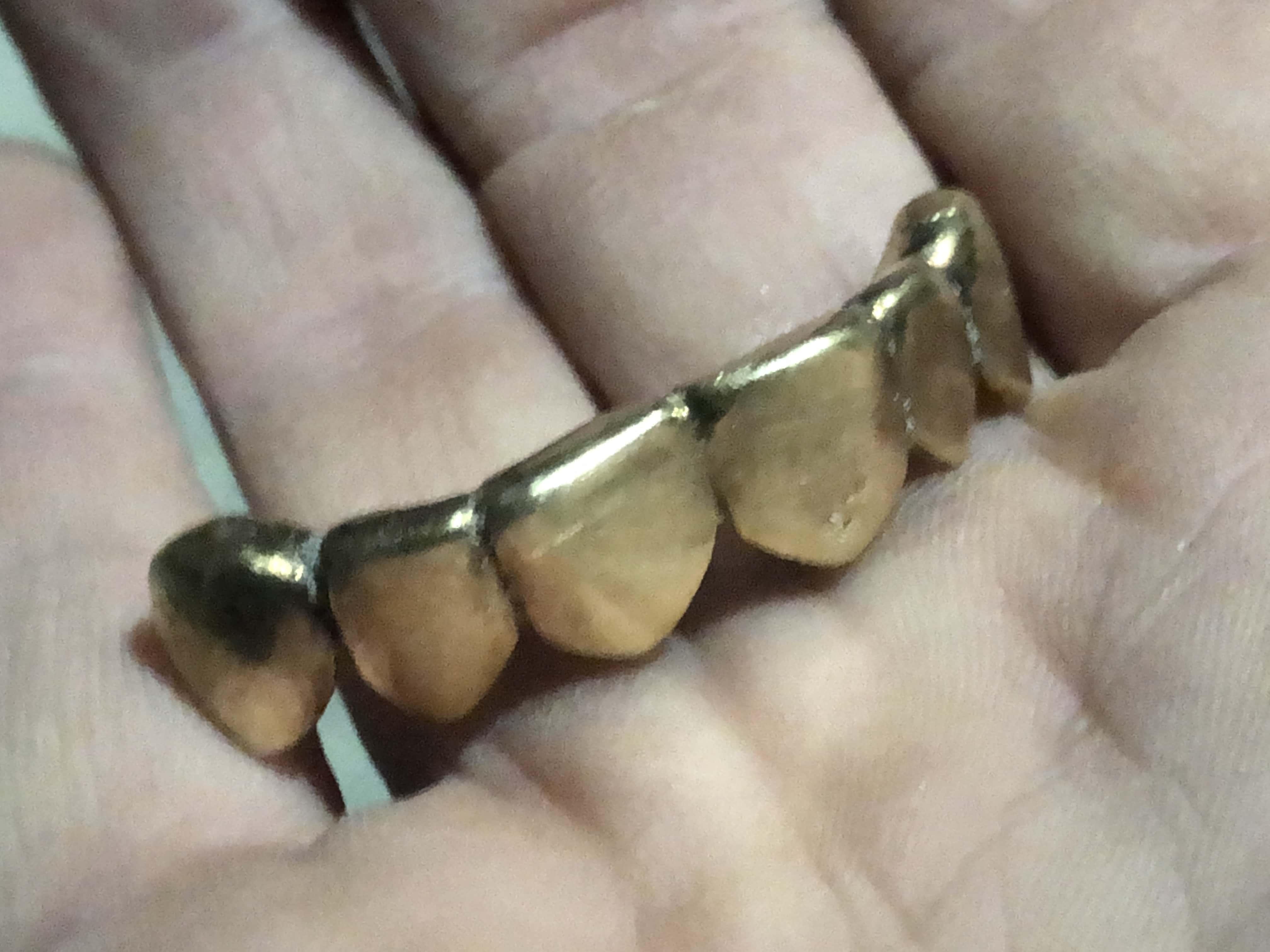 Gold Teeth Grill Laying in a Palm of a Hand Up Close